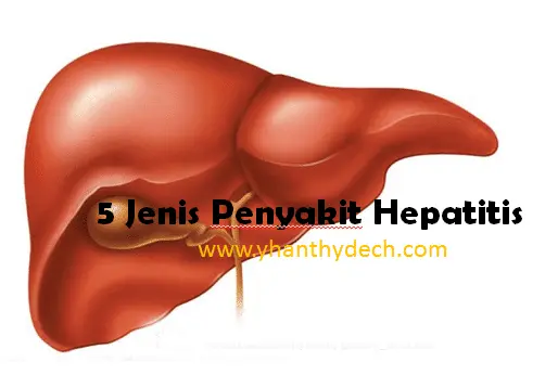 5 Jenis Penyakit Hepatitis